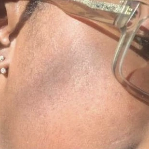 Customer 4: after using Turmeric Plus Soap